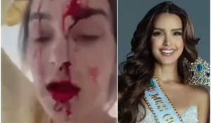 Miss Venezuela acusa o pr&oacute;prio estilista de agredi-la dentro de quarto de hotel em Cannes